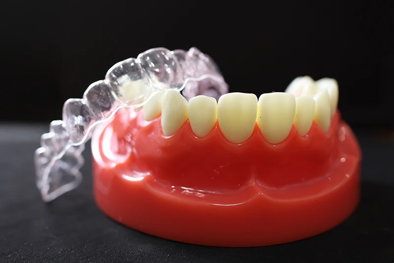 Clear Aligner